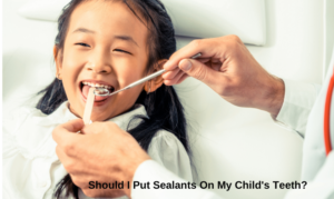sealants