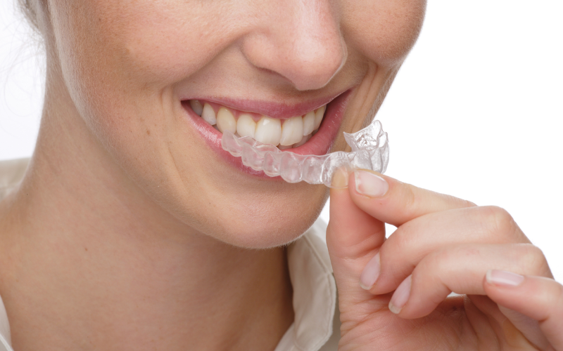 invisalign invisalign