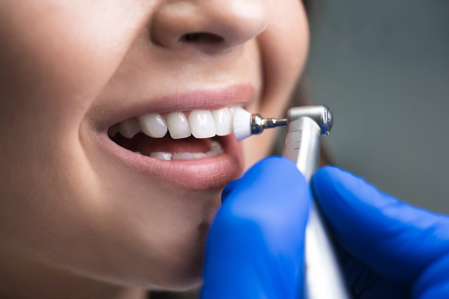 dental cleanings colleyville tx