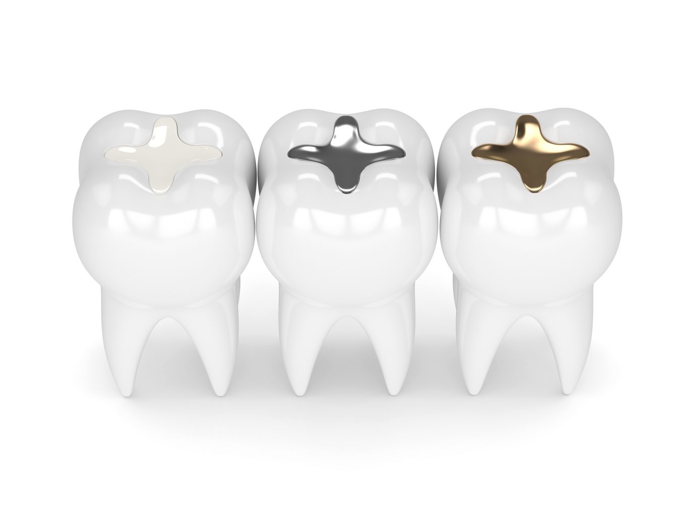 dental fillings in colleyville