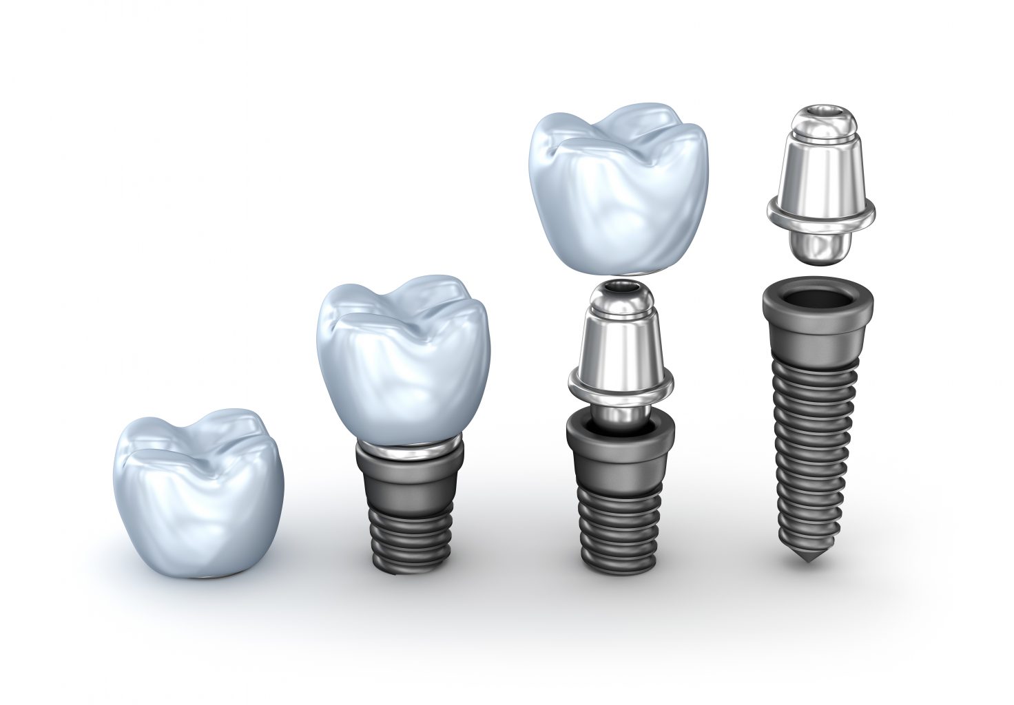 dental implant treatment in colleyville tx