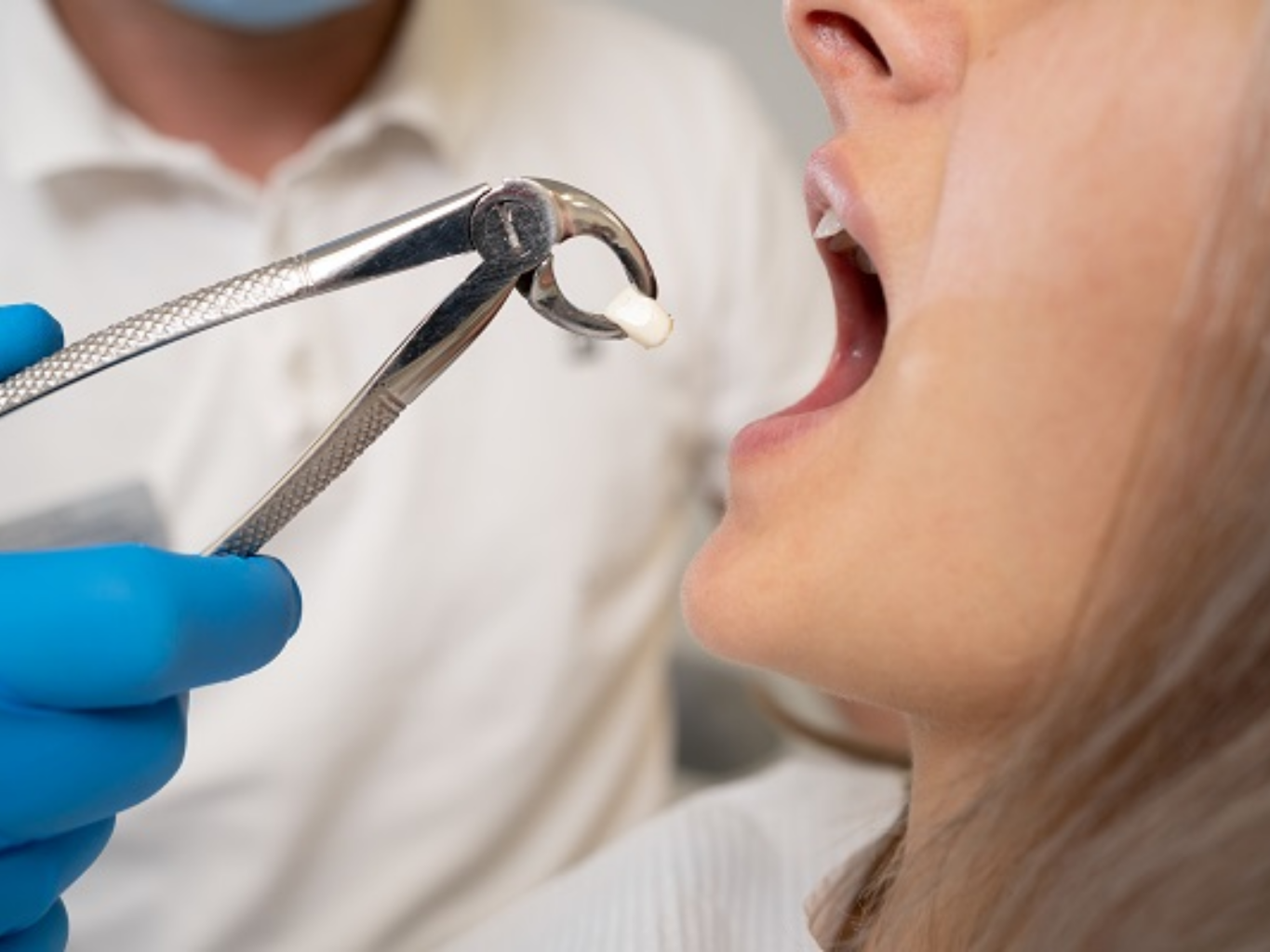 tooth extraction procedure