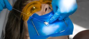 Root canal to preserve teeth