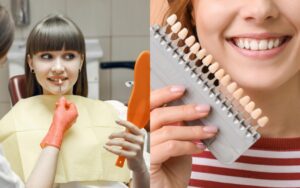 dental veneers or crowns