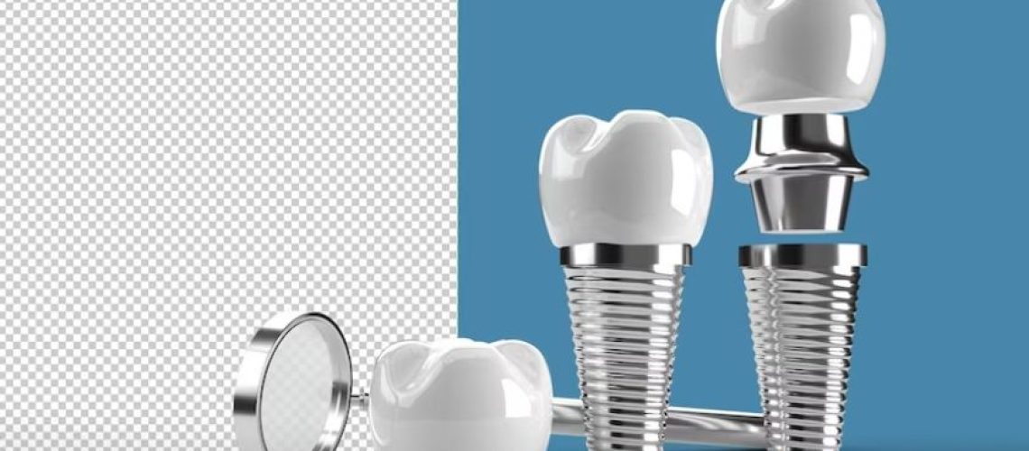 xr:d:DAFvEIUsyaY:2,j:3720376885684717569,t:23092108