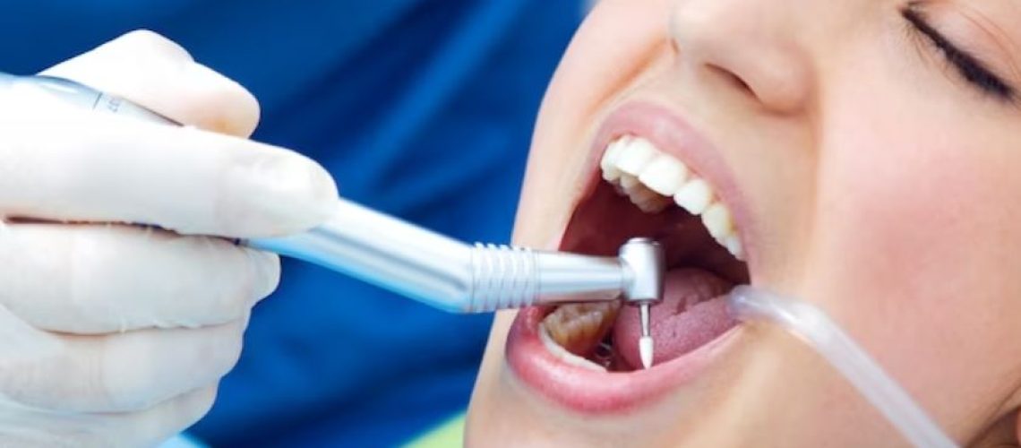 Root Canal -Serene Dental