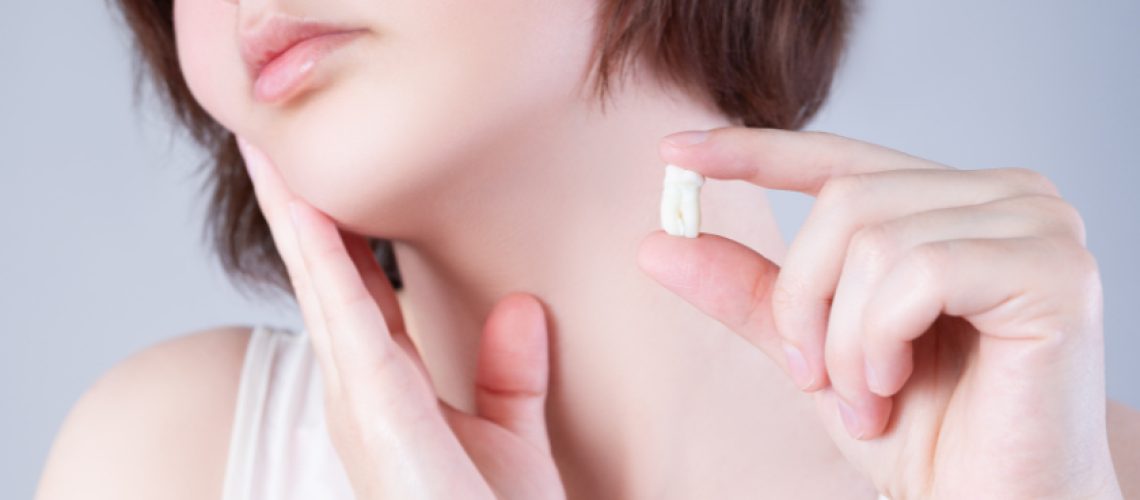 Wisdom Teeth Removal in Colleyville TX, Serene Dental of Colleyville, Dentist, Dentist in Colleyville TX,