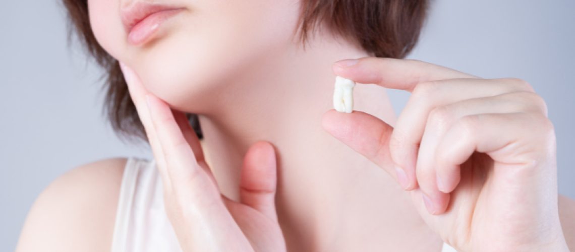 Wisdom Teeth Removal in Colleyville, TX- Serene Dental of Colleyville