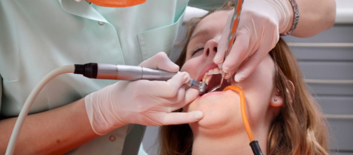 Tooth Extraction in Colleyville TX, Serene Dental of Colleyville,