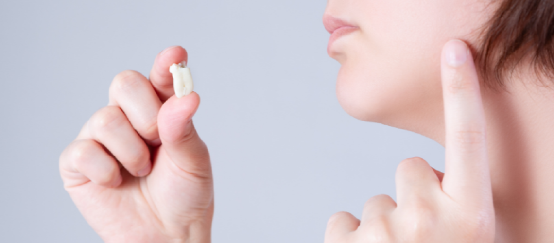 Wisdom Teeth Removal (1)