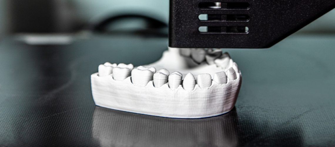 dental crowns to improve overall health