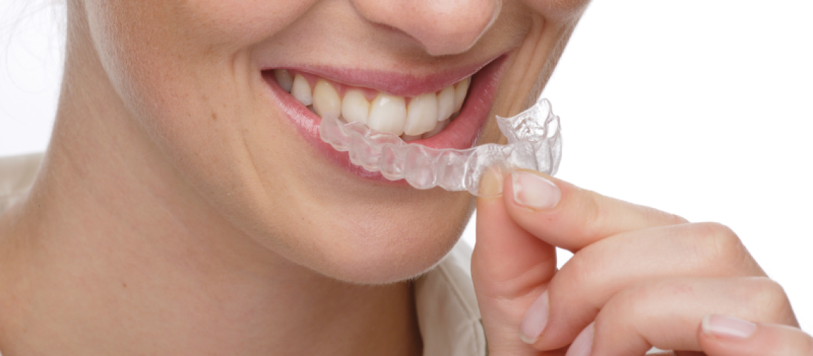 invisalign
