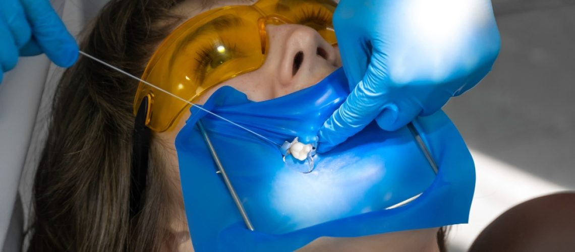 Root canal to preserve teeth